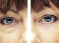 Eyesential Effectiveness